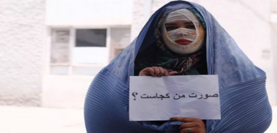 اختلالات روانی که شاید منجر به اسیدپاشی شوند