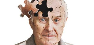 ۶ فاکتور موثر در پیشرفت آلزایمر