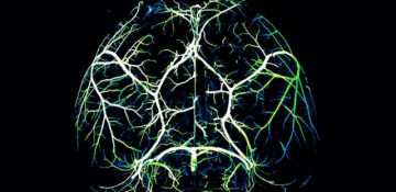 کشف مکانیسم مؤثر در مغز برای مبارزه با آلزایمر