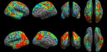 مشاهده میزان از بین رفتن سیناپس‌های مغز در مراحل اولیه آلزایمر