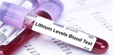 بررسی چگونگی اثر لیتیوم  بر بیماران مبتلا به عارضه دوقطبی