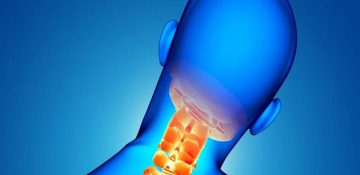 بهبود ۸۰ درصد مبتلایان به دیسک گردن با استفاده از گردن‌بند طبی