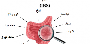 سندرم روده تحریک پذیر (IBS) چیست و چطور درمان می شود؟