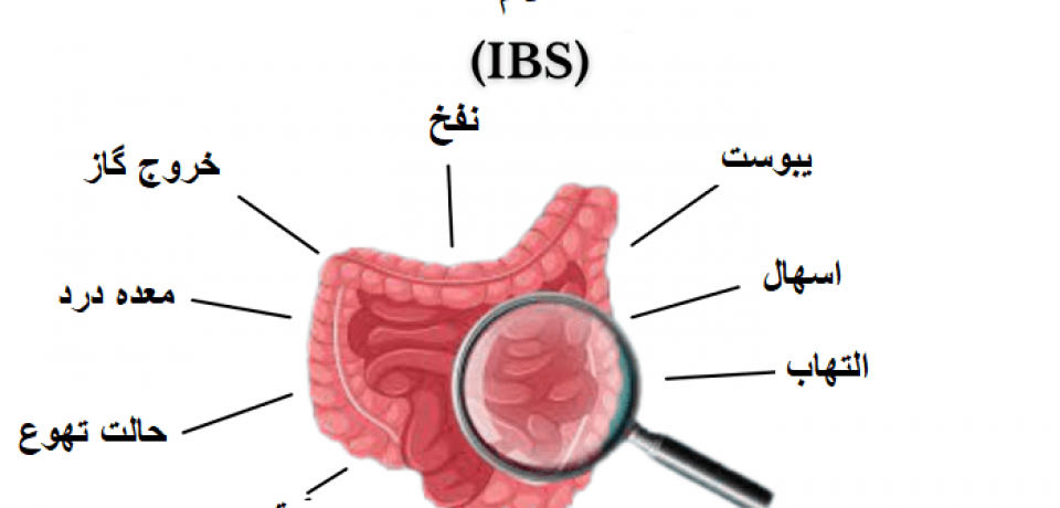 سندرم روده تحریک پذیر (IBS) چیست و چطور درمان می شود؟